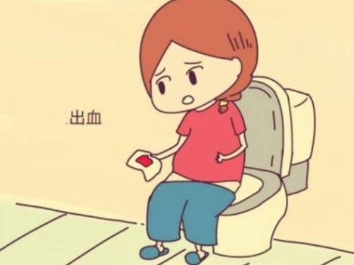 不是和坐羊水穿刺的人群有哪些？做不做取决于你自己